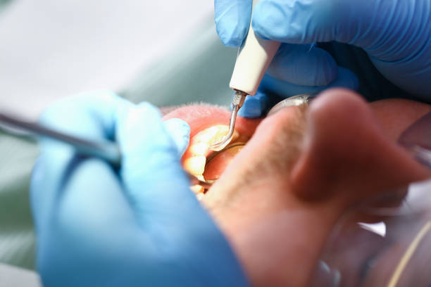Best Holiday Emergency Dentist in Cherry Hill, VA
