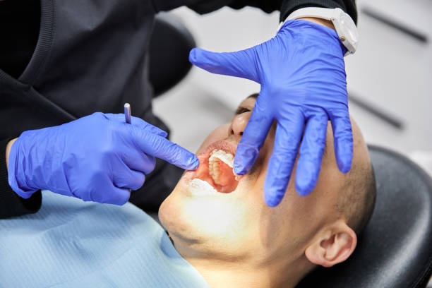 Best Emergency Cosmetic Dentistry in Cherry Hill, VA